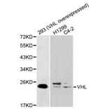 Western blot - VHL Antibody from Signalway Antibody (32075) - Antibodies.com