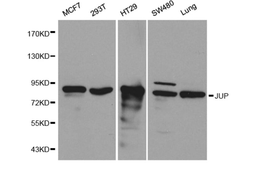 Western blot - JUP Antibody from Signalway Antibody (32095) - Antibodies.com