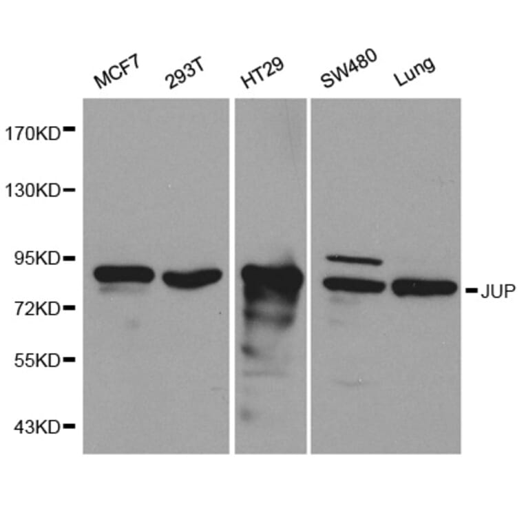 Western blot - JUP Antibody from Signalway Antibody (32095) - Antibodies.com