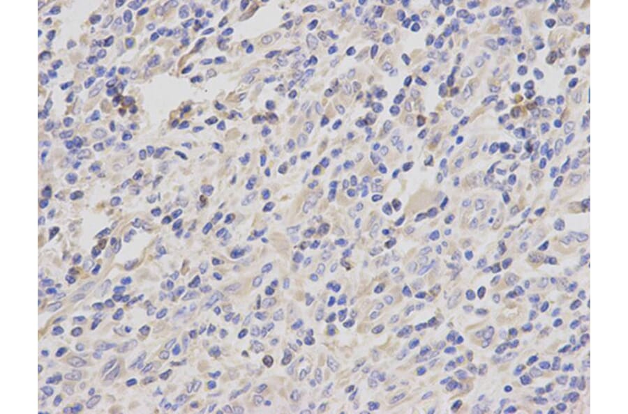 Immunohistochemistry - JUP Antibody from Signalway Antibody (32095) - Antibodies.com