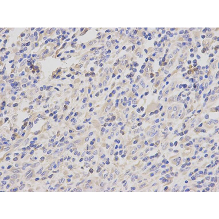 Immunohistochemistry - JUP Antibody from Signalway Antibody (32095) - Antibodies.com