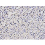 Immunohistochemistry - JUP Antibody from Signalway Antibody (32095) - Antibodies.com