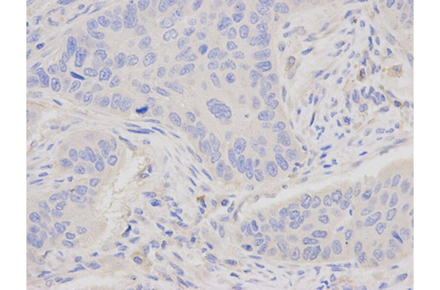 Immunohistochemistry - JUP Antibody from Signalway Antibody (32095) - Antibodies.com