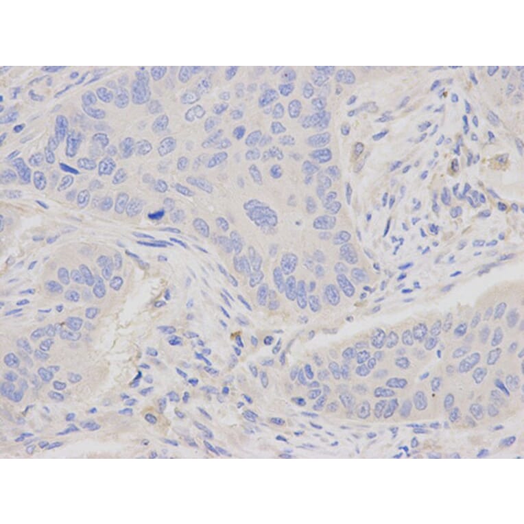 Immunohistochemistry - JUP Antibody from Signalway Antibody (32095) - Antibodies.com