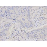 Immunohistochemistry - JUP Antibody from Signalway Antibody (32095) - Antibodies.com