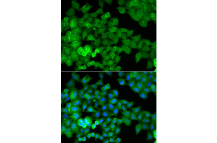 Immunofluorescence - JUP Antibody from Signalway Antibody (32095) - Antibodies.com