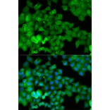 Immunofluorescence - JUP Antibody from Signalway Antibody (32095) - Antibodies.com