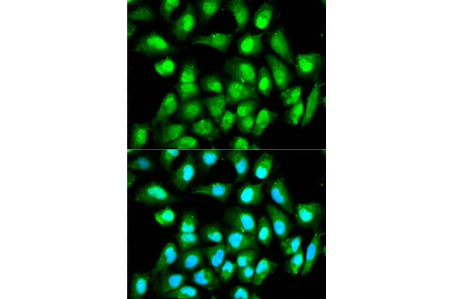 Immunofluorescence - RAN Antibody from Signalway Antibody (32104) - Antibodies.com