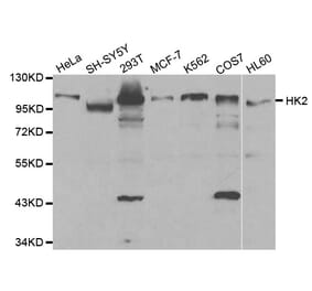 Western blot - HK2 Antibody from Signalway Antibody (32115) - Antibodies.com