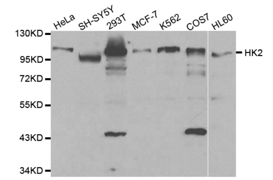 Western blot - HK2 Antibody from Signalway Antibody (32115) - Antibodies.com