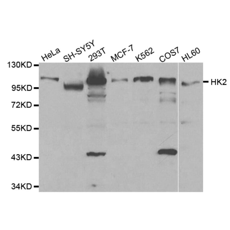 Western blot - HK2 Antibody from Signalway Antibody (32115) - Antibodies.com