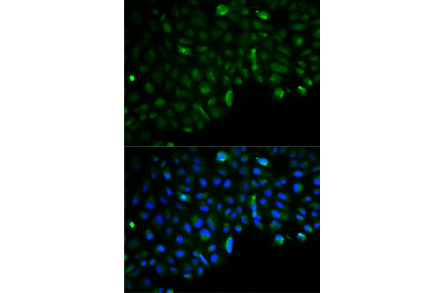 Immunofluorescence - HK2 Antibody from Signalway Antibody (32115) - Antibodies.com