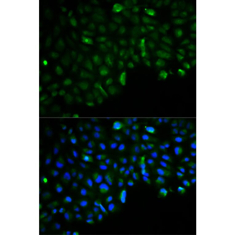 Immunofluorescence - HK2 Antibody from Signalway Antibody (32115) - Antibodies.com