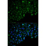 Immunofluorescence - HK2 Antibody from Signalway Antibody (32115) - Antibodies.com