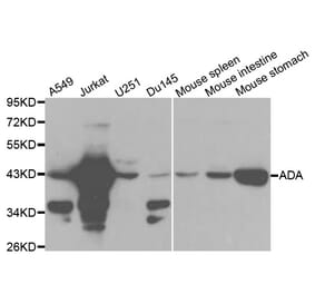 Western blot - ADA Antibody from Signalway Antibody (32121) - Antibodies.com