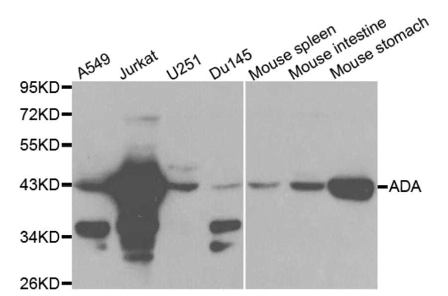 Western blot - ADA Antibody from Signalway Antibody (32121) - Antibodies.com