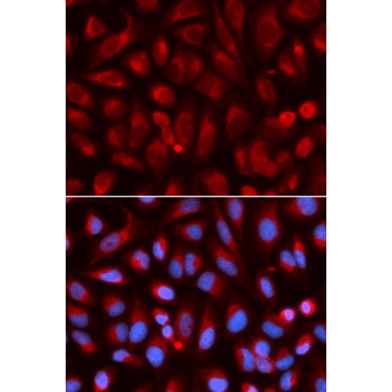 Immunofluorescence - ADA Antibody from Signalway Antibody (32121) - Antibodies.com