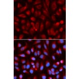 Immunofluorescence - ADA Antibody from Signalway Antibody (32121) - Antibodies.com