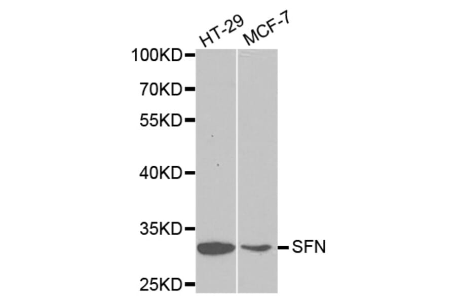 Western blot - SFN Antibody from Signalway Antibody (32126) - Antibodies.com