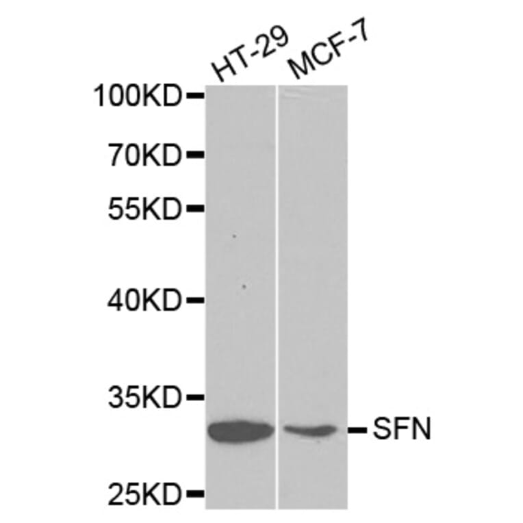 Western blot - SFN Antibody from Signalway Antibody (32126) - Antibodies.com