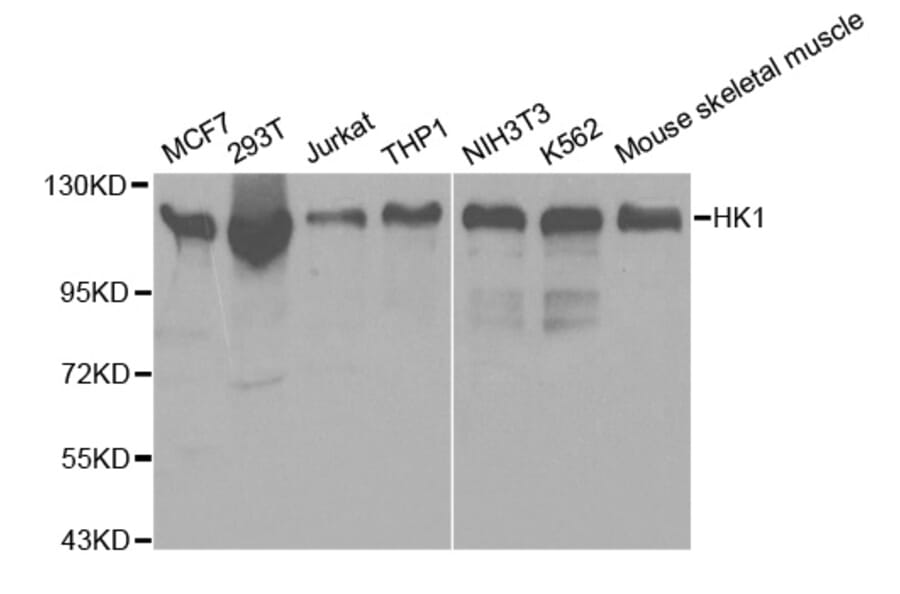 Western blot - HK1 Antibody from Signalway Antibody (32133) - Antibodies.com