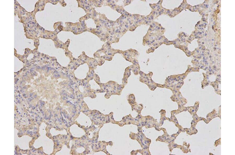Immunohistochemistry - HK1 Antibody from Signalway Antibody (32133) - Antibodies.com