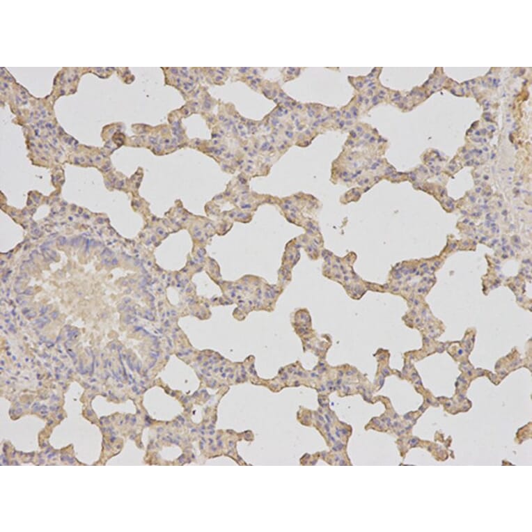 Immunohistochemistry - HK1 Antibody from Signalway Antibody (32133) - Antibodies.com
