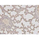 Immunohistochemistry - HK1 Antibody from Signalway Antibody (32133) - Antibodies.com