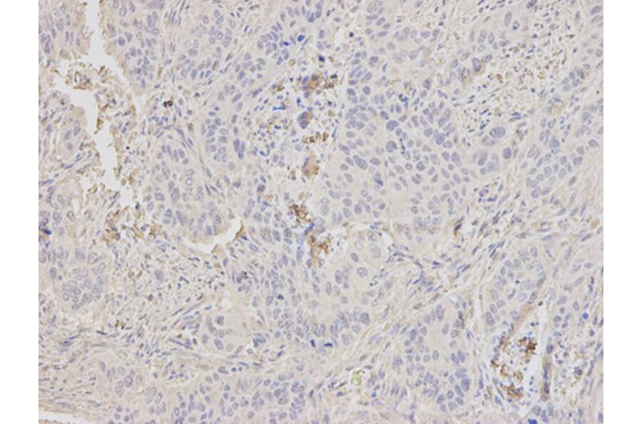 Immunohistochemistry - HK1 Antibody from Signalway Antibody (32133) - Antibodies.com
