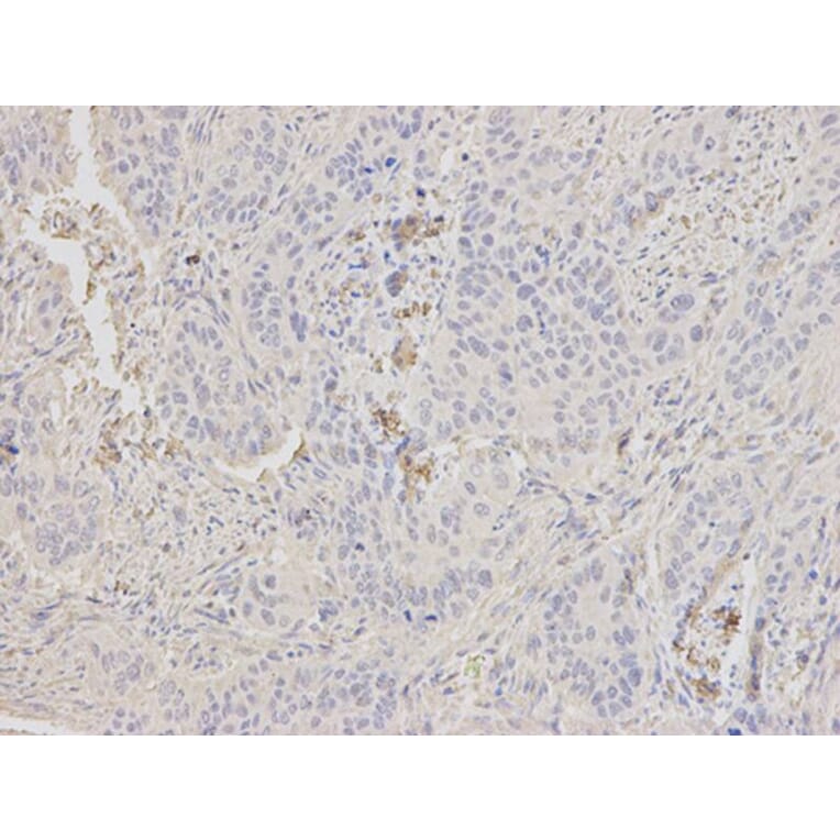 Immunohistochemistry - HK1 Antibody from Signalway Antibody (32133) - Antibodies.com
