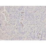 Immunohistochemistry - HK1 Antibody from Signalway Antibody (32133) - Antibodies.com