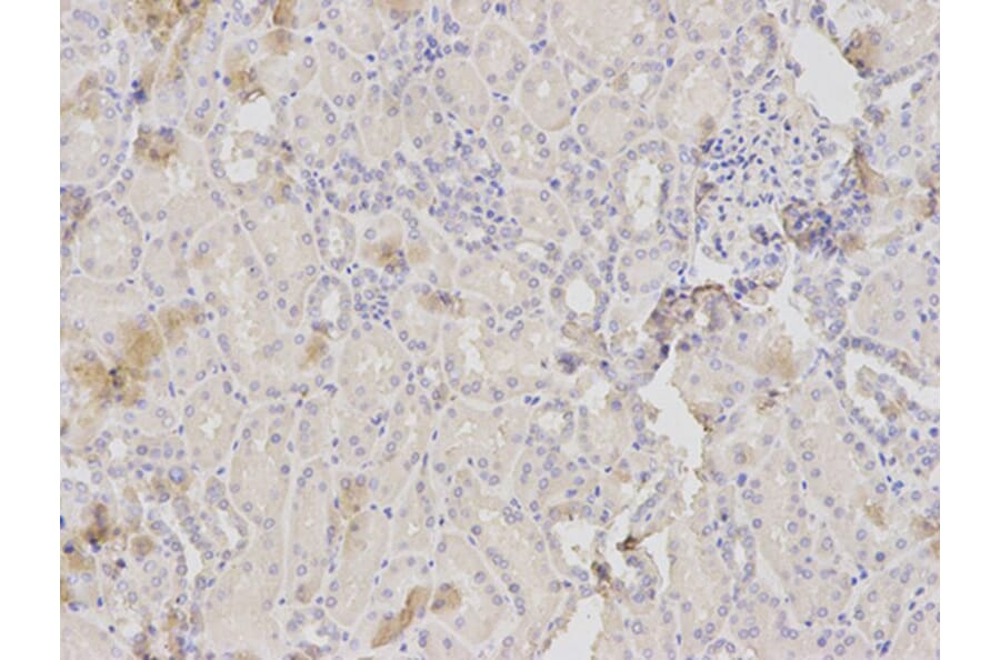 Immunohistochemistry - HK1 Antibody from Signalway Antibody (32133) - Antibodies.com