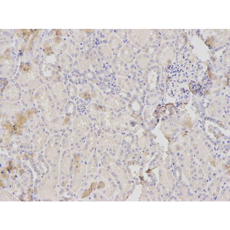 Immunohistochemistry - HK1 Antibody from Signalway Antibody (32133) - Antibodies.com