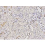 Immunohistochemistry - HK1 Antibody from Signalway Antibody (32133) - Antibodies.com