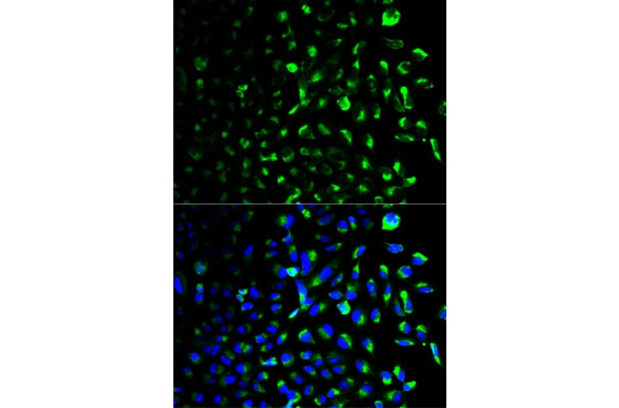 Immunofluorescence - HK1 Antibody from Signalway Antibody (32133) - Antibodies.com