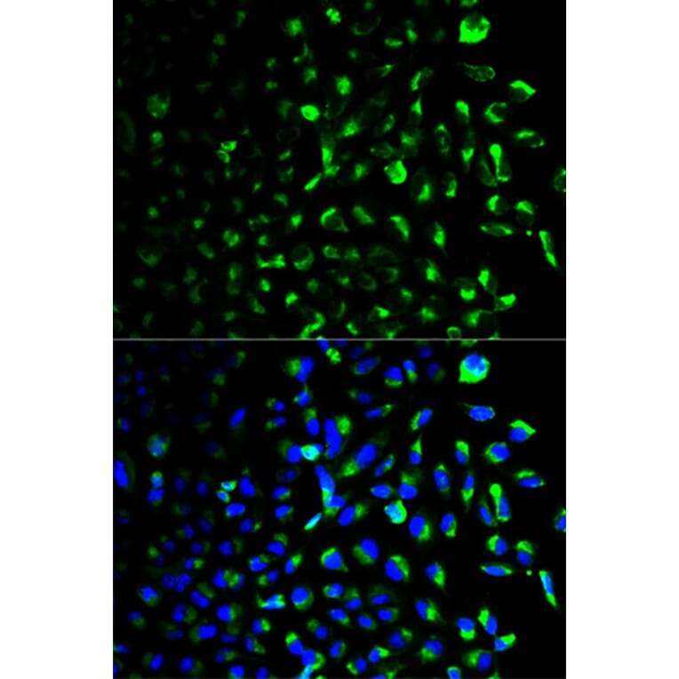 Immunofluorescence - HK1 Antibody from Signalway Antibody (32133) - Antibodies.com