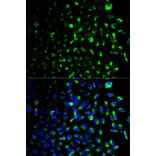 Immunofluorescence - HK1 Antibody from Signalway Antibody (32133) - Antibodies.com