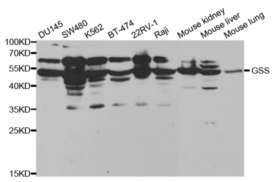 Western blot - GSS Antibody from Signalway Antibody (32143) - Antibodies.com