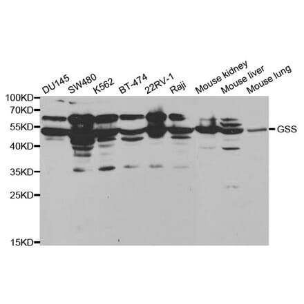 Western blot - GSS Antibody from Signalway Antibody (32143) - Antibodies.com