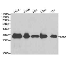 Western blot - EMD Antibody from Signalway Antibody (32172) - Antibodies.com