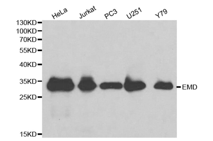 Western blot - EMD Antibody from Signalway Antibody (32172) - Antibodies.com