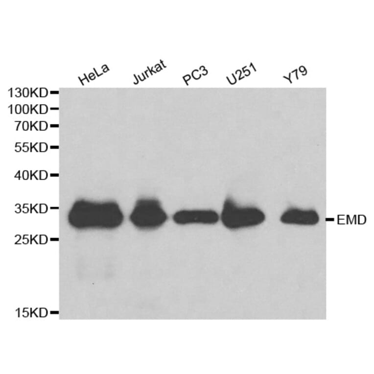 Western blot - EMD Antibody from Signalway Antibody (32172) - Antibodies.com