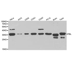 Western blot - FBL Antibody from Signalway Antibody (32174) - Antibodies.com