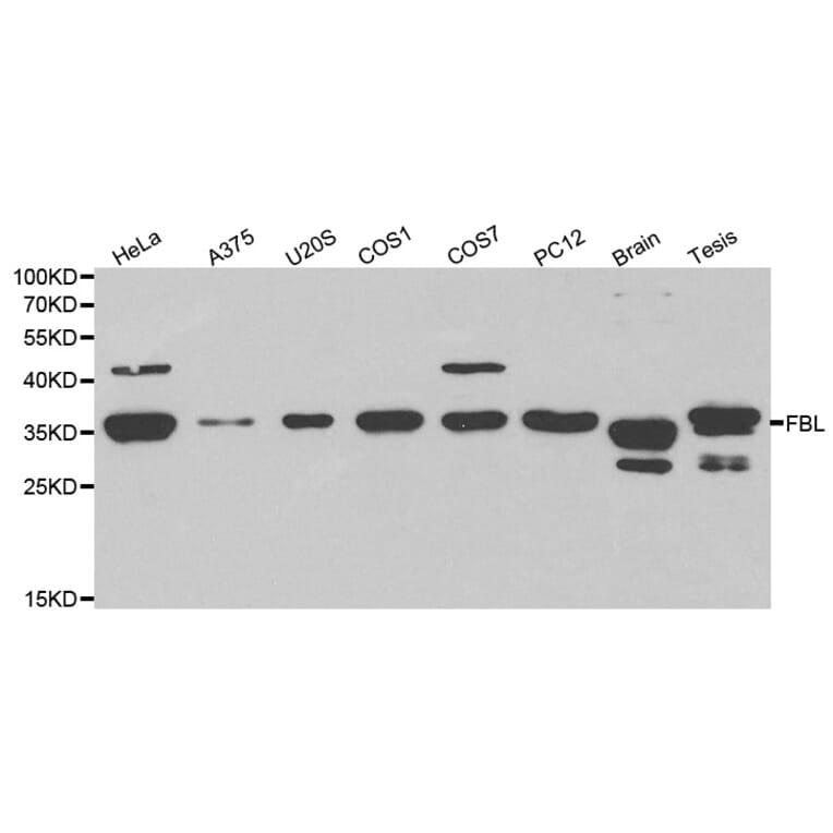 Western blot - FBL Antibody from Signalway Antibody (32174) - Antibodies.com