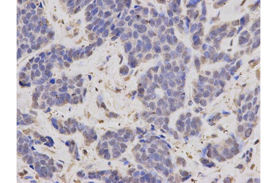 Immunohistochemistry - FBL Antibody from Signalway Antibody (32174) - Antibodies.com
