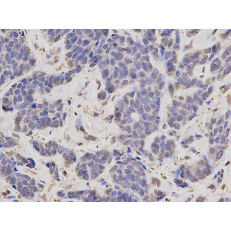 Immunohistochemistry - FBL Antibody from Signalway Antibody (32174) - Antibodies.com