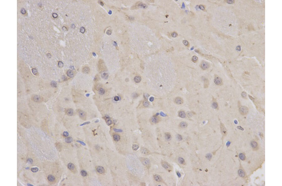 Immunohistochemistry - FBL Antibody from Signalway Antibody (32174) - Antibodies.com