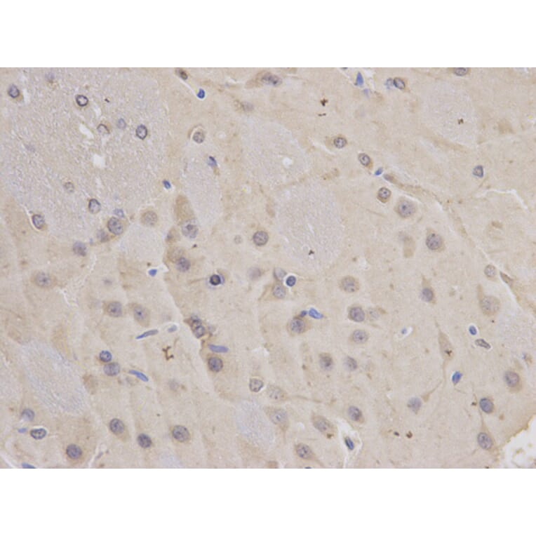 Immunohistochemistry - FBL Antibody from Signalway Antibody (32174) - Antibodies.com