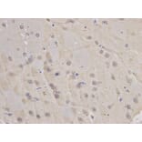 Immunohistochemistry - FBL Antibody from Signalway Antibody (32174) - Antibodies.com