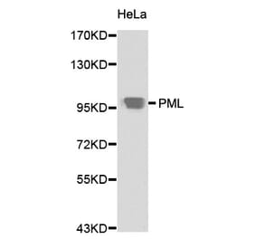 Western blot - PML Antibody from Signalway Antibody (32211) - Antibodies.com